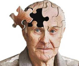 علائم بیماری آلزایمر